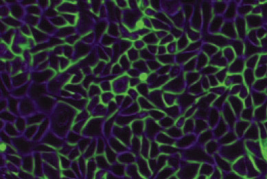 Green and black Keratinocyte-neonatal skin cells.