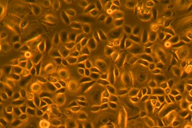 Fluorescent orange and black primary bronchial tracheal epithelial cells.