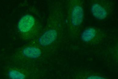 Green human umbilical vein endothelial cells.