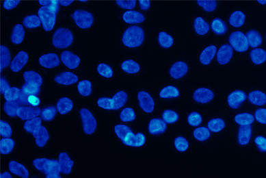 Blue and black cells.