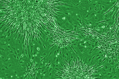 CRL-1658-fibroblast-mouse-embryo-foci-of-growth Green mouse embryo fibroblast.