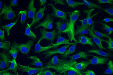 Green and blue epithelial htert cells.