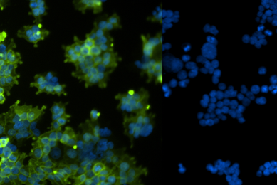 Green and blue human embryonic kidney cells.