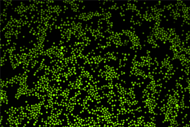 Green K562-GFP with nuclear stain.
