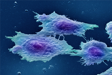 Human colon cancer cells.