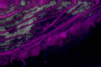 Purple and white human HeLa cancer cell cytokinesis.