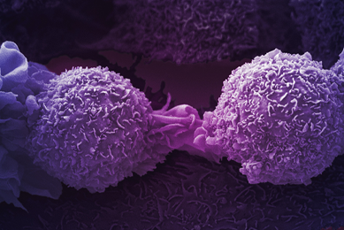 Purple lung cancer cells.