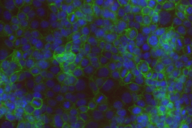 Fluorescent blue and green colon cells.