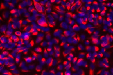 Fluorescent red and blue, red, and black colon cells.