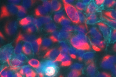 Fluorescent blue, purple, and red, lung, epithelial mesenchymal transition reporter cells.