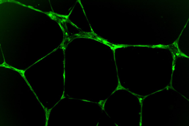 Green tubulogenesis microvascular endothelial cell.