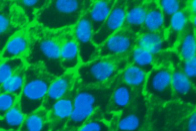 Fluorescent lime green and blue web of renal proximal tubular epithelial cells.