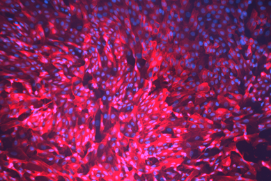 Blue and pink hTER renal proximal tubular epithelial cells.