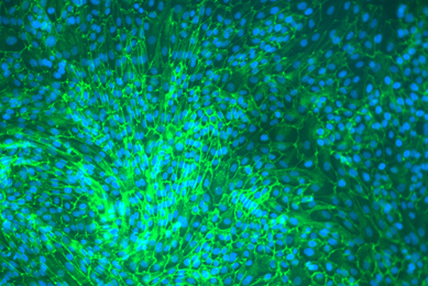 Green hTER renal proximal tubular epithelial cells.
