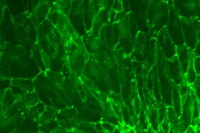 Green hTER renal proximal tubular epithelial cells.