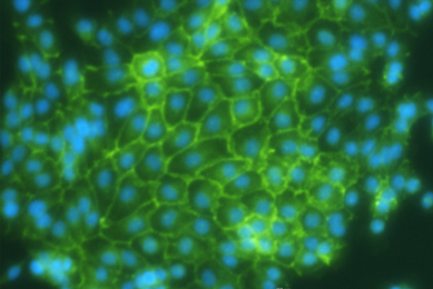 Web-like, fluorescent green and blue renal proximal tubular epithelial cells.