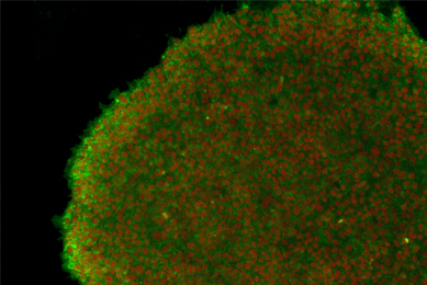 Green and red IPS stem cells.