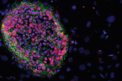 Purple and green merged IPS nanog cells.