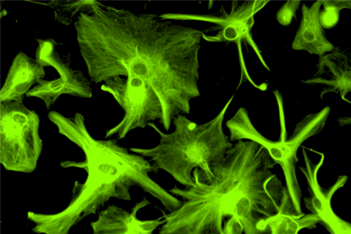 Green Oligodentrocytes neural progenitor cells.