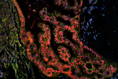 Blue, pink and green IPS organoid cells.
