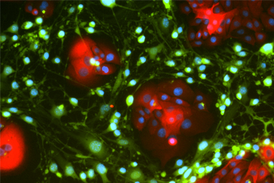 Green and red conditionally reprogrammed organoid cells.