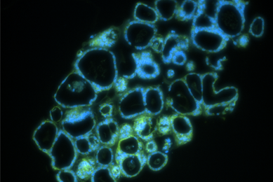 Blue and green ecad488 organoid cells.