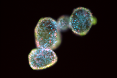 Blue and green 488 ck20 organoid cells.