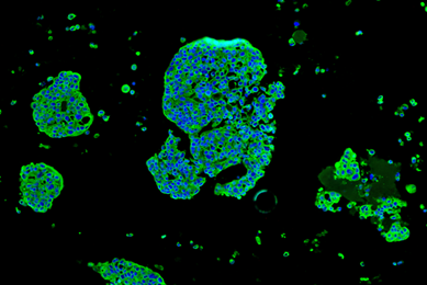 Mcf7 breast cancer cell line.