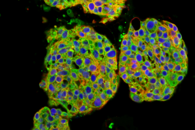 BT20 EGFR cell line.