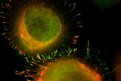 Orange and green K-562 bone marrow cells.