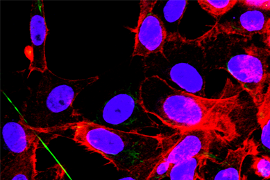 Purple and red HTB-9 B-Catenin monolayer cells.