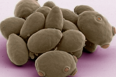 Purple saccharomyces cerevisiae yeast.