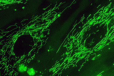 Green fluorescent mitochondria in 895 Sk cells.