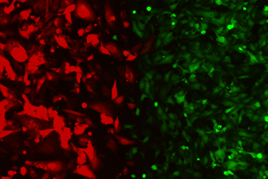 Red and green HeLa HUVEC cells.