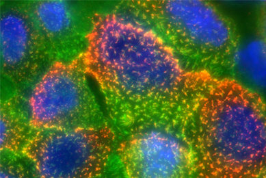Fluorescent spheres and particles of green, blue, orange, and yellow.