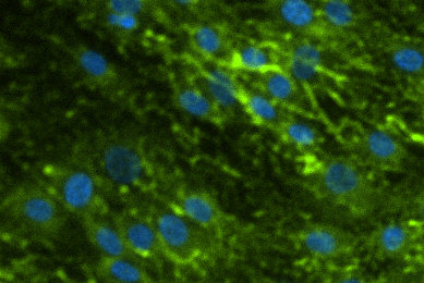 Green and blue gingival fibroblast.