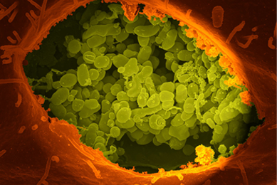 Green and red vero cell.