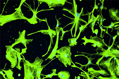 Green oligodentrocyte cells.