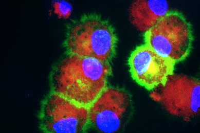 Fluorescent red, lime green, purple, and blue dendritic cells.