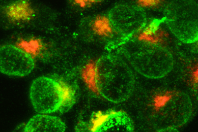 Fluorescent orange and lime green spheres of white blood cells.