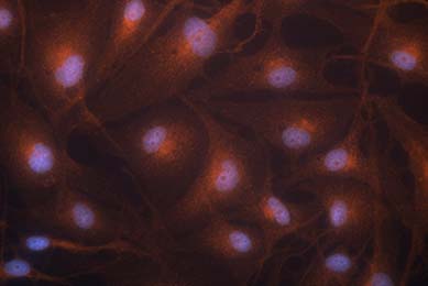 hTERT immortalized neonatal dermal melanocyte ATCC CRL-4064 human TRP1 staining