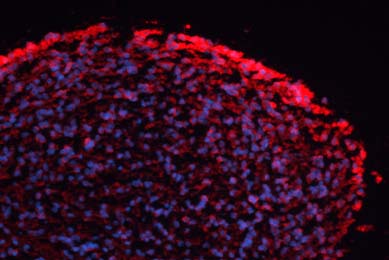 Neural progenitor cell derived neurosphere