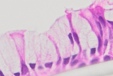 alcian blue stain airway histology primary bronchial cells
