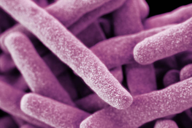 Cluster of thin, pink, rod-shaped Mycobacterium tuberculosis.