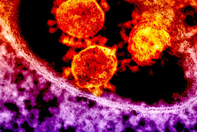 Grainy, red-orange and purple spheres of Middle East respiratory syndrome coronavirus.