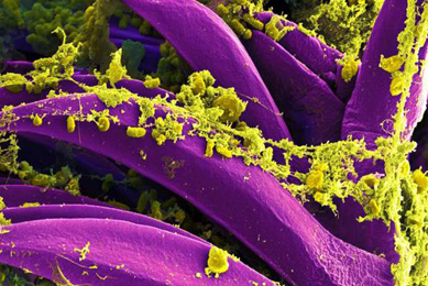 Purple, banana-shaped Yersinia pestis bacteria with yellow-green growths.