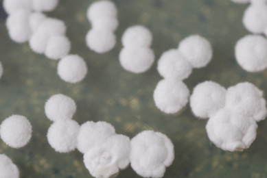 White, dry, fuzzy, clusters of bacteria.