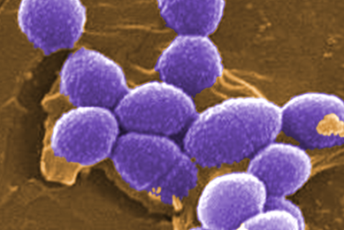 Purple spheres of Enterococcus faecalis bacteria.