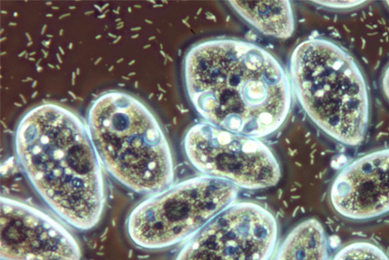 Transparent spheres of blue, white and brown Ciliophora.