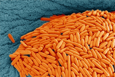 Baby carrot-like pile of Clostridium difficile bacteria. 